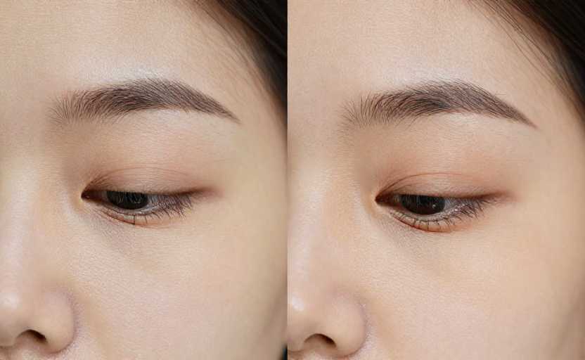 Dietary supplement bottle labels